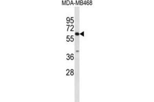 Western Blotting (WB) image for anti-Carboxylesterase 5A (CES5A) antibody (ABIN3004057) (CES5A antibody)