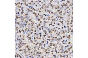 Immunohistochemistry (IHC) image for anti-Histone 3 (H3) (H3K27me) antibody (ABIN3023269)