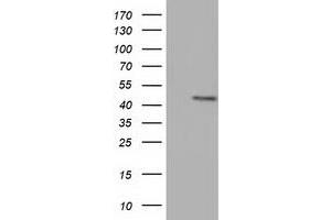 Western Blotting (WB) image for anti-COBW Domain Containing 1 (CBWD1) antibody (ABIN1497114) (CBWD1 antibody)