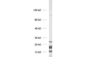 dilution: 1 : 1000, sample: rat brain homogenate (MBP antibody)