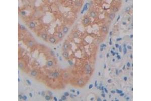 IHC-P analysis of Human Tissue, with DAB staining. (SAT1 antibody  (AA 1-171))