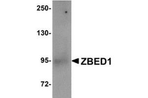 Western blot analysis of ZBED1 in A549 cell lysate with this product at 1 μg/ml. (ZBED1 antibody  (Center))