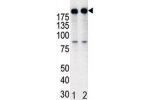 Western blot analysis of anti-HER2 in T47D cell lysate, either noninduced (Lane 1) or induced with HRG (2). (ErbB2/Her2 antibody  (AA 1227-1255))