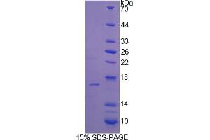 Image no. 1 for Phospholipase A2, Group IID (PLA2G2D) (AA 20-134) protein (His tag) (ABIN6238440) (PLA2G2D Protein (AA 20-134) (His tag))