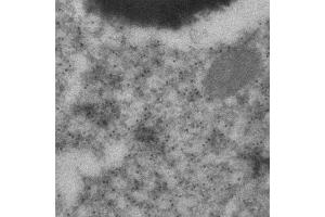 Immunogold labeling of epithelium cells (GFP antibody)
