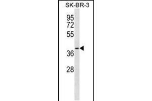 Western blot analysis in SK-BR-3 cell line lysates (35ug/lane). (SFXN3 antibody  (C-Term))