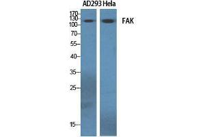 Western Blot (WB) analysis of specific cells using FAK Polyclonal Antibody. (FAK antibody  (Thr451))