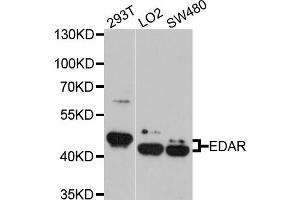 Western blot analysis of extracts of various cell lines, using EDAR antibody. (EDAR antibody)
