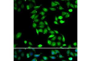 Immunofluorescence analysis of HeLa cells using PDCD6 Polyclonal Antibody (PDCD6 antibody)