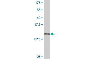 Western Blot detection against Immunogen (35. (PITX2 antibody  (AA 189-270))