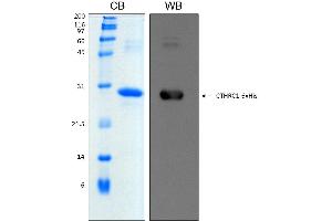 15% SDS-PAGE stained with Coomassie Blue (CB), immunobloting with anti-His (WB) and peptide fingerprinting by MALDI-TOF mass spectrometry (CTHRC1 Protein (AA 31-243) (His tag))