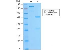 SDS-PAGE (SDS) image for anti-B-Cell CLL/lymphoma 2 (BCL2) antibody (ABIN6940502)