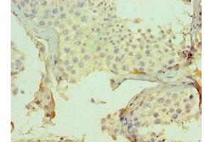 Immunohistochemistry of paraffin-embedded human testis tissue using ABIN7147732 at dilution of 1:100 (CMA1 antibody  (AA 1-247))