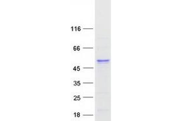 TXNDC5 Protein (Transcript Variant 2) (Myc-DYKDDDDK Tag)