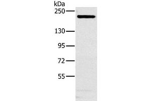 Western Blot analysis of Hela cell using NCOA3 Polyclonal Antibody at dilution of 1:200 (NCOA3 antibody)