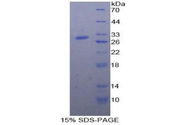 A2ML1 Protein