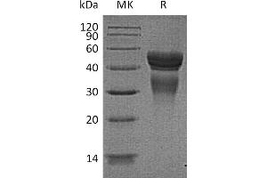 Greater than 95 % as determined by reducing SDS-PAGE. (IL12 Protein)