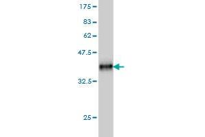 Western Blot detection against Immunogen (37. (PLAUR antibody  (AA 25-134))