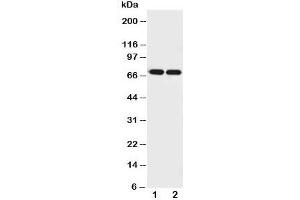 Western blot testing of Netrin 1 antibody and Lane 1:  U87;  2: COLO320 cell lysate. (Netrin 1 antibody  (AA 32-51))