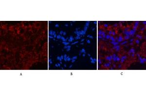 Immunofluorescence analysis of rat lung tissue. (CD4 antibody)