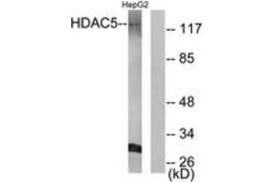 Western blot analysis of extracts from HepG2 cells, using HDAC5 (Ab-259) Antibody. (HDAC5 antibody  (AA 225-274))