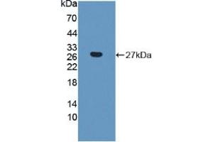 Figure. (CTHRC1 antibody  (AA 31-243))