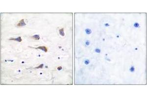 Immunohistochemistry (IHC) image for anti-Glutamate Receptor, Metabotropic 6 (GRM6) (AA 828-877) antibody (ABIN1533291)