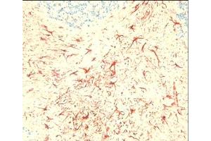 Immunohistochemical staining on mouse brain sections using C5aR antibody ABIN113333. (C5AR1 antibody  (C-Term))