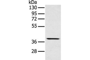 Western blot analysis of Mouse muscle tissue using MAFA Polyclonal Antibody at dilution of 1:400 (MAFA antibody)