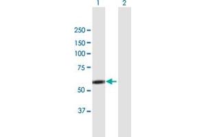 Western Blot analysis of LYN expression in transfected 293T cell line by LYN MaxPab polyclonal antibody. (LYN antibody  (AA 1-512))