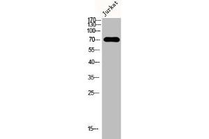 Western Blot analysis of Jurkat cells using DMPK Polyclonal Antibody (DMPK antibody  (N-Term))