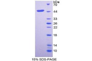 SDS-PAGE (SDS) image for Thymic Stromal Lymphopoietin (TSLP) (AA 21-138) protein (His tag,GST tag) (ABIN1980922) (Thymic Stromal Lymphopoietin Protein (TSLP) (AA 21-138) (His tag,GST tag))