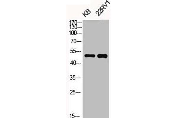 OPRK1 antibody  (pSer369)