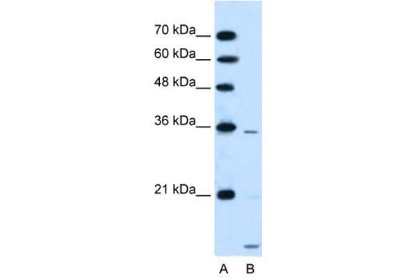 SLC25A39 antibody  (C-Term)