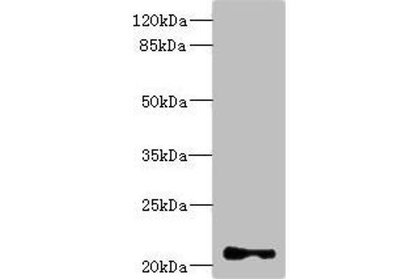 TNNI2 antibody  (AA 1-100)