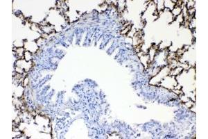 IHC testing of FFPE rat lung tissue with Periostin antibody at 1ug/ml. (Periostin antibody)