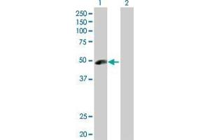 Lane 1: ANGPTL5 transfected lysate ( 44. (ANGPTL5 293T Cell Transient Overexpression Lysate(Denatured))