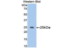 Western Blotting (WB) image for anti-Matrix Metallopeptidase 11 (Stromelysin 3) (MMP11) (AA 287-491) antibody (ABIN1078305) (MMP11 antibody  (AA 287-491))