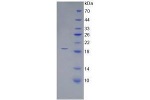 SDS-PAGE analysis of Human Corin Protein. (Corin Protein)