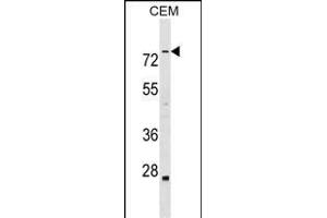 ABLIM3 Antibody (C-term) (ABIN1537502 and ABIN2849050) western blot analysis in CEM cell line lysates (35 μg/lane). (ABLIM3 antibody  (C-Term))