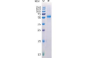 Human Protein, His Tag on SDS-PAGE under reducing condition. (LAG3 Protein (AA 23-245) (His tag))