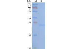 Human TM4SF1-Nanodisc, Flag Tag on SDS-PAGE (TM4SF1 Protein)