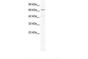 Image no. 1 for anti-Zinc Finger Protein 419 (ZNF419) (N-Term) antibody (ABIN6735998) (ZNF419 antibody  (N-Term))