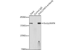 Immunoprecipitation analysis of 300 μg extracts of HeLa cells using 3 μg Dot1L/KMT4 antibody (ABIN7266837). (DOT1L antibody)