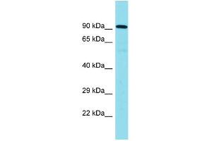 Host: Rabbit Target Name: CNOT10 Sample Type: Placenta lysates Antibody Dilution: 1. (CNOT10 antibody  (C-Term))