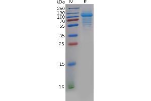 Human IL5RA Protein, hFc Tag on SDS-PAGE under reducing condition. (IL5RA Protein (AA 21-338) (Fc Tag))