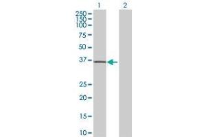 Lane 1: TALDO1 transfected lysate ( 37. (TALDO1 293T Cell Transient Overexpression Lysate(Denatured))