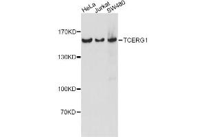 Western blot analysis of extracts of various cell lines, using TCERG1 antibody (ABIN6291557) at 1:1000 dilution. (TCERG1 antibody)