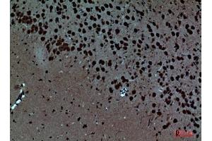 Immunohistochemical analysis of paraffin-embedded Mouse-brain, antibody was diluted at 1:100. (Pleiotrophin antibody  (Internal Region))