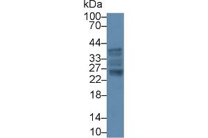 Detection of IL6 in Canine Liver lysate using Polyclonal Antibody to Interleukin 6 (IL6) (IL-6 antibody  (AA 18-207))